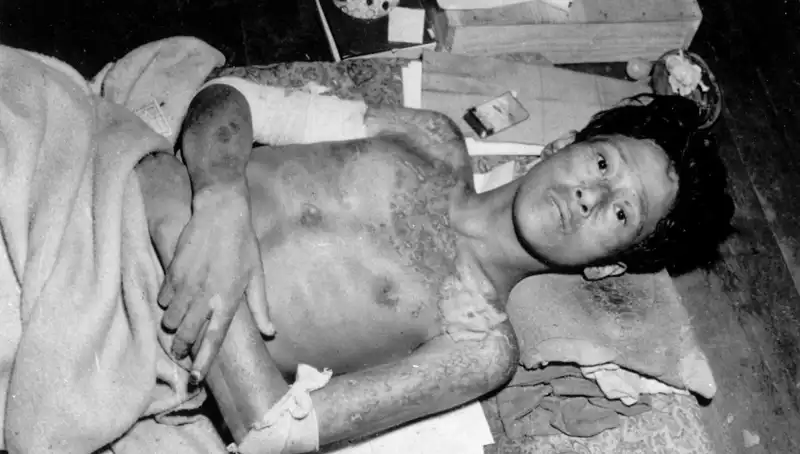 Nagasaki’den Gelen Akıl Dışı Uyarı: Nükleer Felaket Tehlikesi