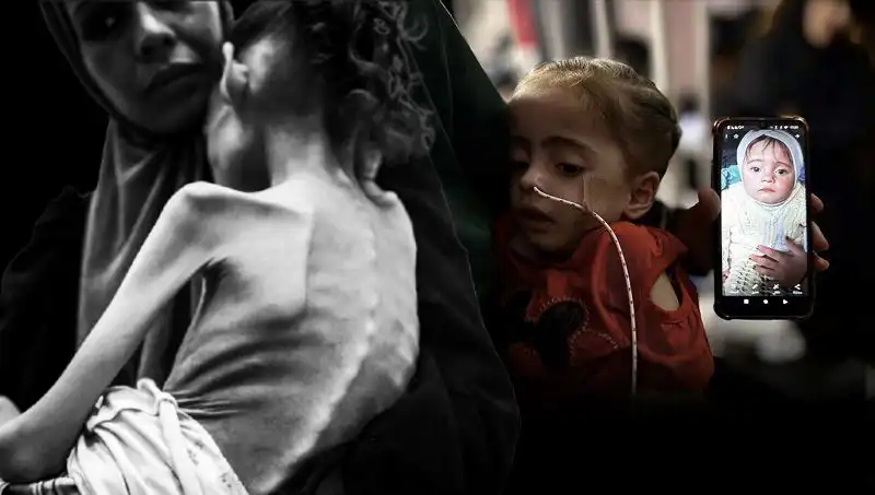 Küçük Meryem'in Zorlu Mücadelesi: Açlıkla Baş Ediyor